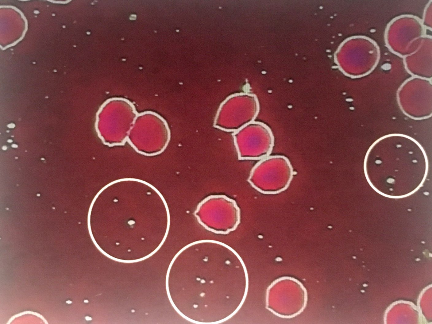 一滴血檢測儀鏡下乳糜微粒