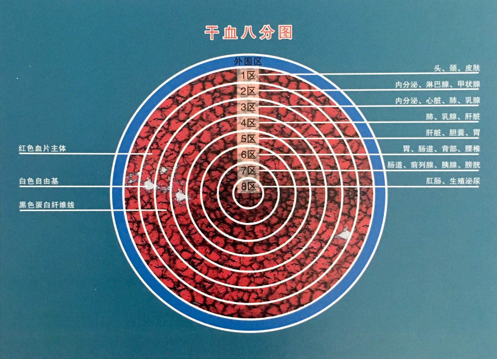 一滴血檢測儀檢測干血片的觀察意義