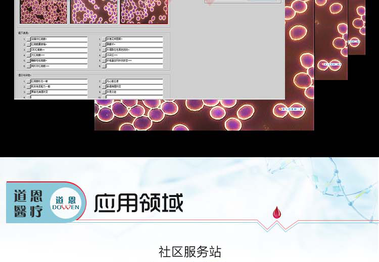 微循環檢測儀，一滴血檢測儀廠家