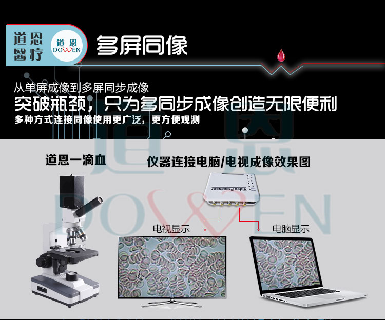 微循環檢測儀，一滴血檢測儀廠家