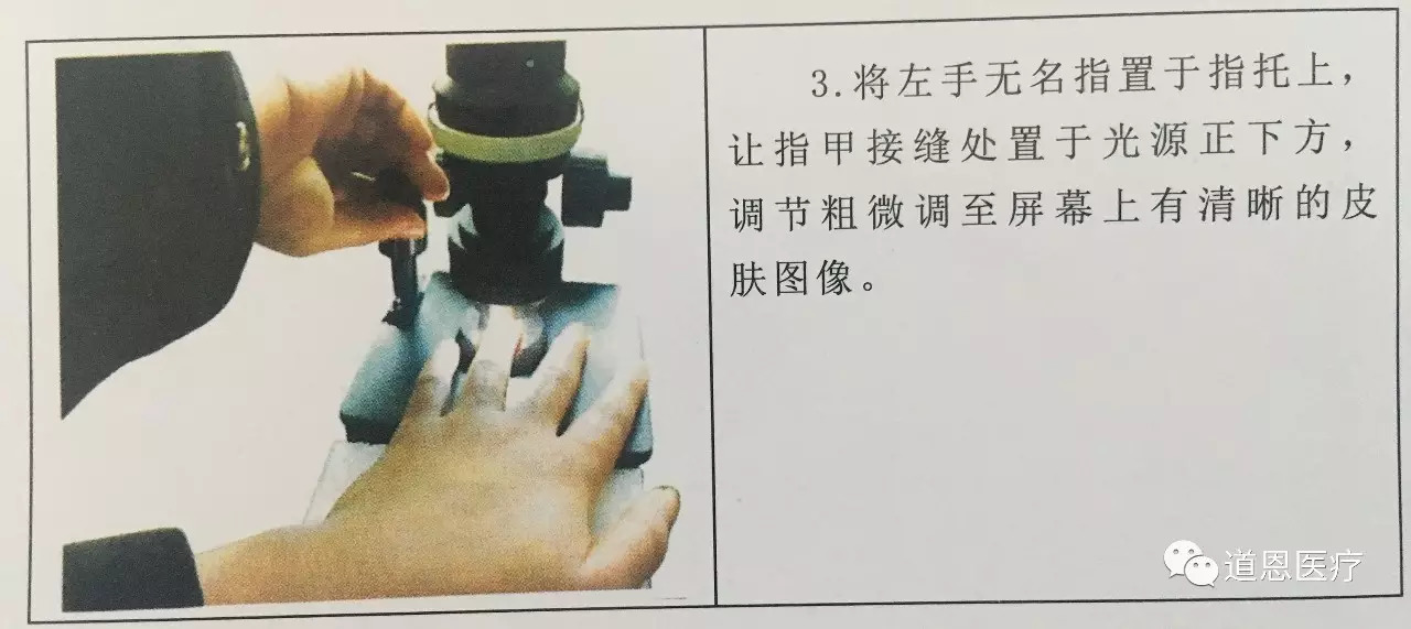 微循環檢測儀，一滴血檢測儀廠家