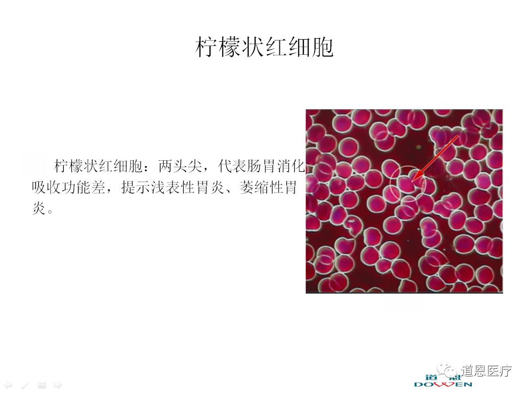 微循環檢測儀，一滴血檢測儀廠家