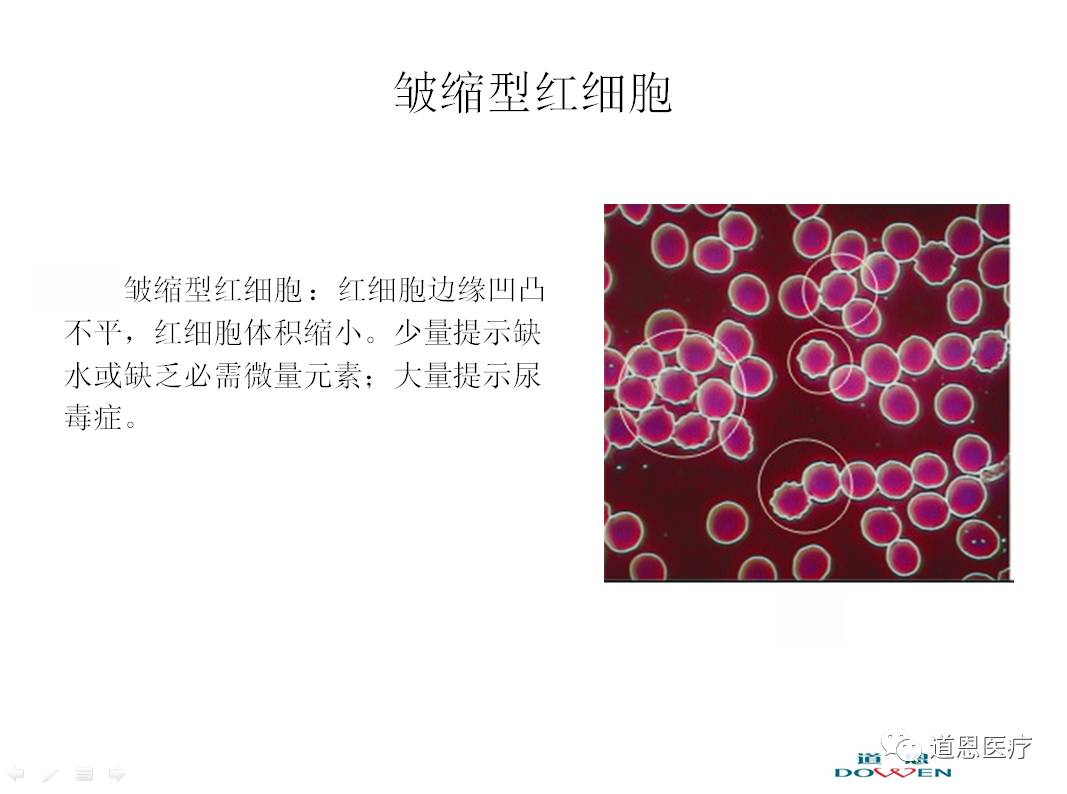 微循環檢測儀，一滴血檢測儀廠家