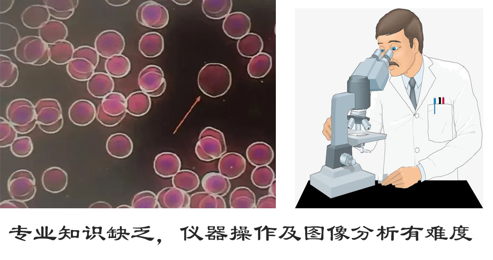 微循環檢測儀，一滴血檢測儀廠家
