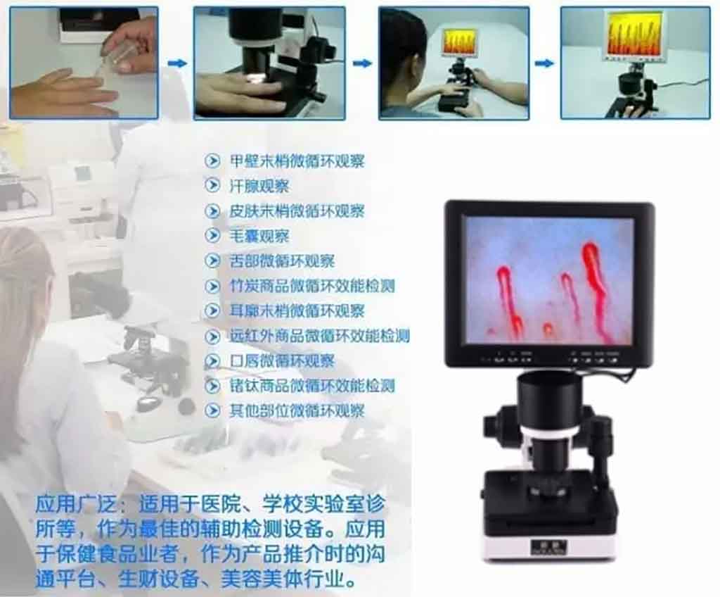 藥店診所檢測活動必備神器之微循環檢測儀