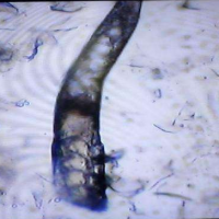 螨蟲檢測儀作用于美容院該如何檢查螨蟲