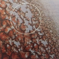 一滴血檢測儀的干血分析與自由基理論