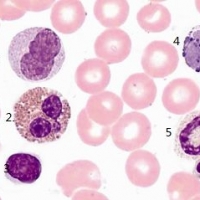 一滴血檢測儀器理論基礎之人體血液細胞形態學