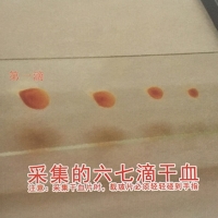 一滴血檢測的血片標本制作方法