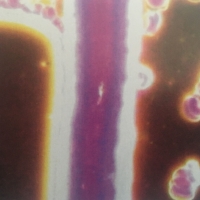 血細胞培訓內容之活血樣本在鏡下的結晶與晶體結構