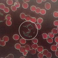 一滴血檢測儀檢測活血血樣