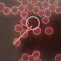 一滴血檢測儀檢測活血血樣:細菌