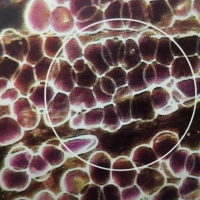 一滴血檢測儀檢測活血血樣:紅細胞血象分析