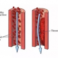 微循環檢測儀檢測身體微循環，預防亞健康
