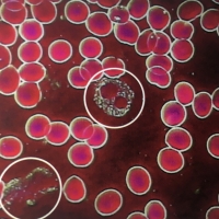 一滴血檢測儀檢測活血血樣:白細胞血象分析