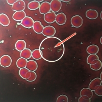 黑背景一滴血檢測儀|認識血小板