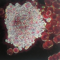 一滴血檢測儀檢測活血血樣:結晶體