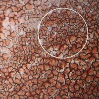 一滴血檢測儀檢測干血圖譜講解