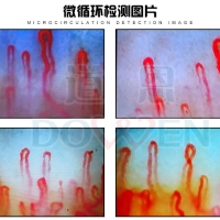 微循環檢測儀|甲襞微循環的特點