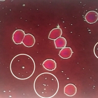 一滴血檢測儀鏡下乳糜微粒