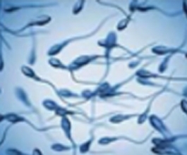 動物精子檢測