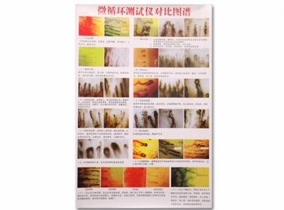 微循環檢測圖
