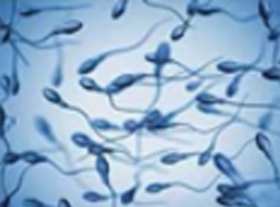 動物精子檢測